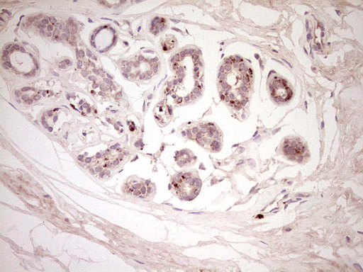 Immunohistochemical staining of paraffin-embedded Human breast tissue within the normal limits using anti-CTGF mouse monoclonal antibody