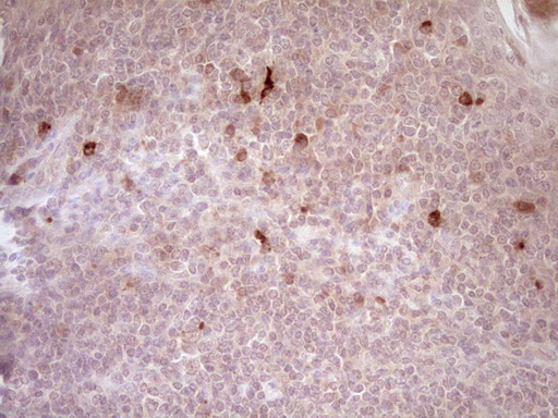 Immunohistochemical staining of paraffin-embedded Human tonsil within the normal limits using anti-CTGF mouse monoclonal antibody