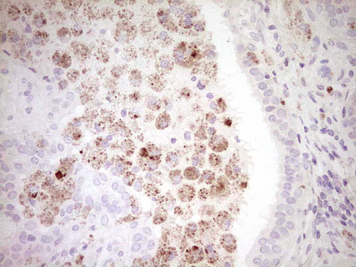 m33931 anti ccn2 mouse monoclonal antibody clone id oti2c9 ihc testing 4