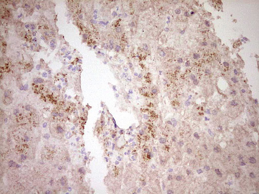 m33931 anti ccn2 mouse monoclonal antibody clone id oti2c9 ihc testing 5