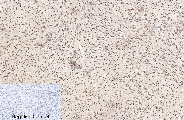 m33947 histone h3 primary antibodyes ihc testing 10
