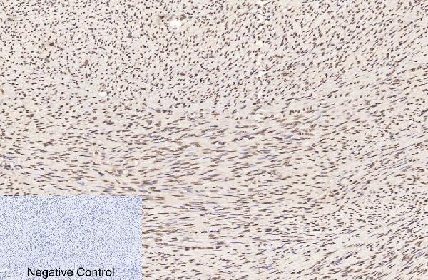 m33947 histone h3 primary antibodyes ihc testing 11
