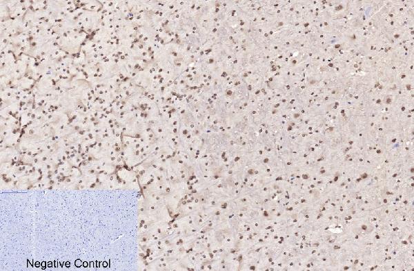 m33947 histone h3 primary antibodyes ihc testing 12