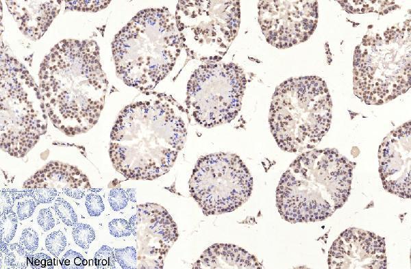 m33947 histone h3 primary antibodyes ihc testing 16