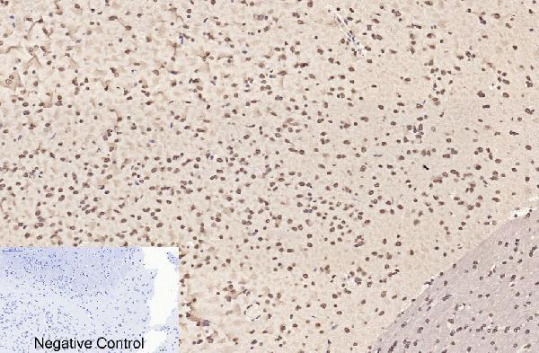 m33947 histone h3 primary antibodyes ihc testing 17