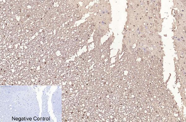 m33947 histone h3 primary antibodyes ihc testing 19