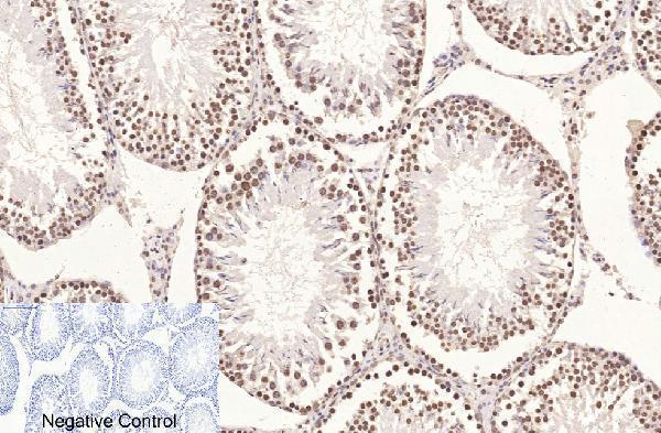m33947 histone h3 primary antibodyes ihc testing 21