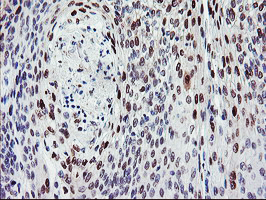 m33956 anti bach1 mouse monoclonal antibody clone id oti4e11 ihc testing 3
