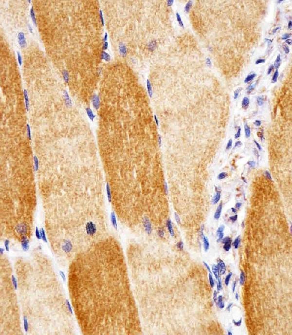 m33970 1 anti sodm antibody ihc p testing 2