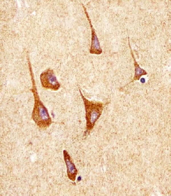 m33970 1 anti sodm antibody ihc p testing 3