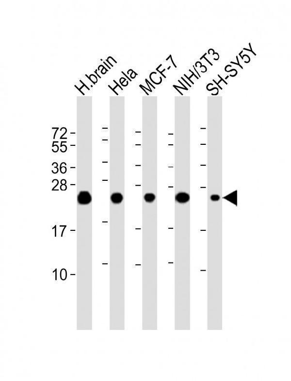 m33970 1 anti sodm antibody wb testing 1