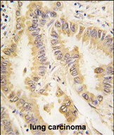 m33970 anti sod2 antibody ihc p testing 3