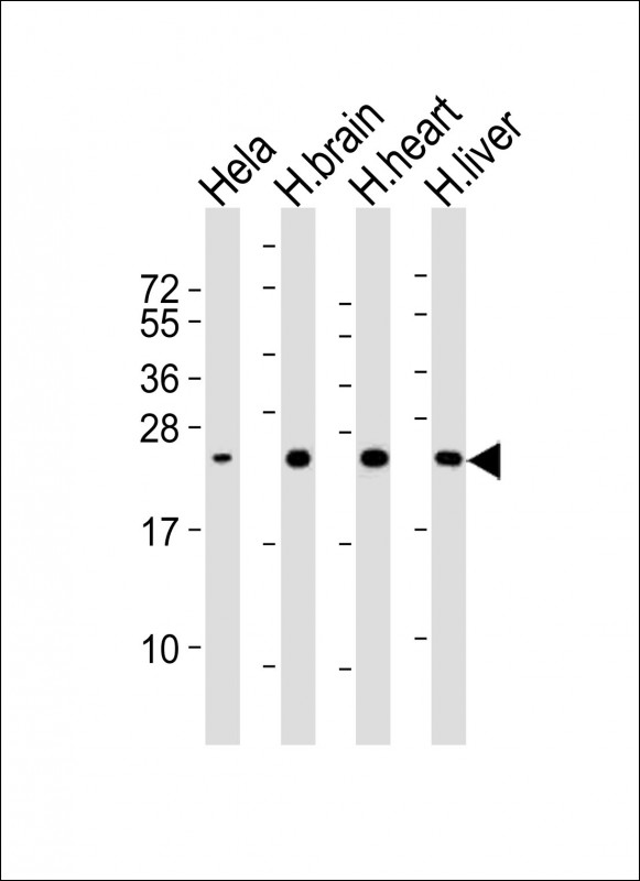 m33970 anti sod2 antibody wb testing 2