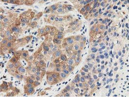 m33989 anti znrd2 mouse monoclonal antibody clone id oti2f5 ihc testing 10
