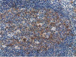 m33989 anti znrd2 mouse monoclonal antibody clone id oti2f5 ihc testing 11