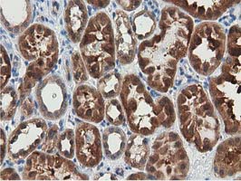 m33989 anti znrd2 mouse monoclonal antibody clone id oti2f5 ihc testing 12