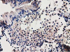 m33989 anti znrd2 mouse monoclonal antibody clone id oti2f5 ihc testing 5