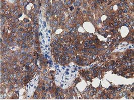 m33989 anti znrd2 mouse monoclonal antibody clone id oti2f5 ihc testing 6
