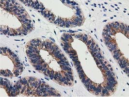 m33989 anti znrd2 mouse monoclonal antibody clone id oti2f5 ihc testing 7