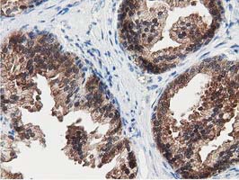 m33989 anti znrd2 mouse monoclonal antibody clone id oti2f5 ihc testing 8