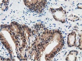 m33989 anti znrd2 mouse monoclonal antibody clone id oti2f5 ihc testing 9