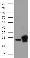 HEK293T cells were transfected with the pCMV6-ENTRY control (Left lane) or pCMV6-ENTRY SSSCA1 (Right lane) cDNA for 48 hrs and lysed