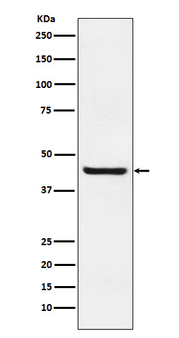 Western blot analysis of Septin 2 expression in Jurkat cell lysate