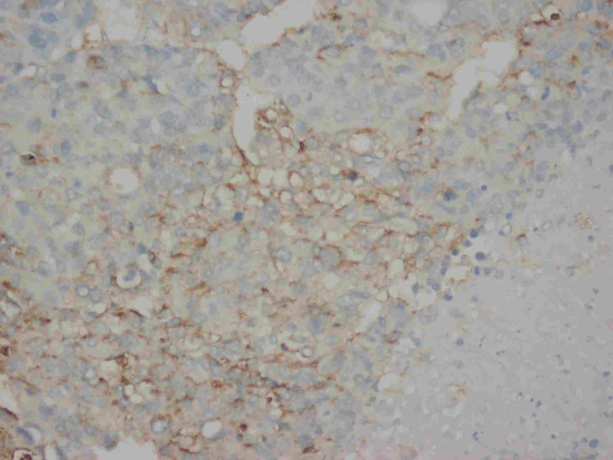 Anti-AFP/Alpha 1 Fetoprotein Antibody (Monoclonal, 35A50)