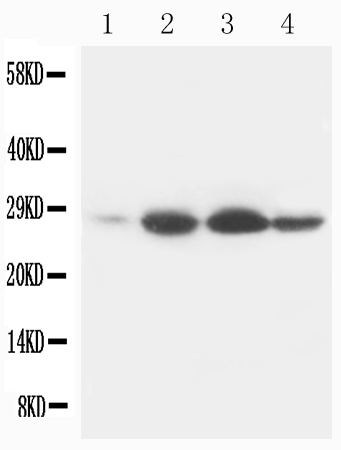 Anti-Bcl-2 Antibody (Monoclonal, 35B51)
