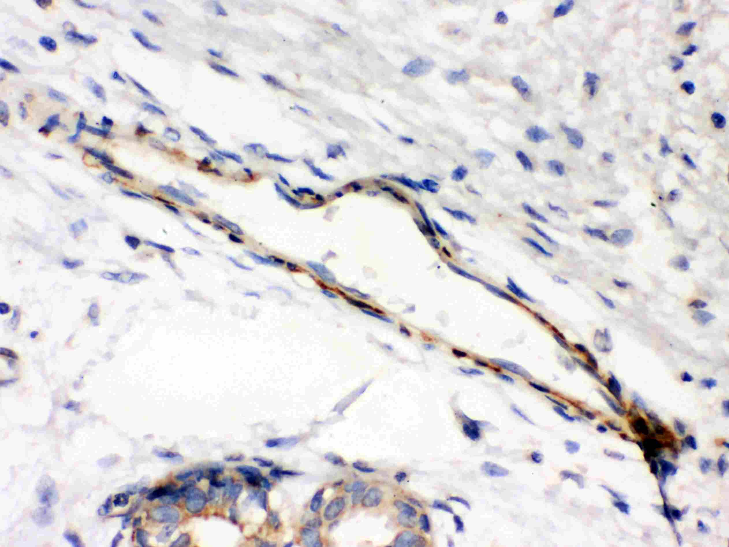 Anti-Caldesmon (Smooth) Cald1 Antibody (Monoclonal, 35C53)