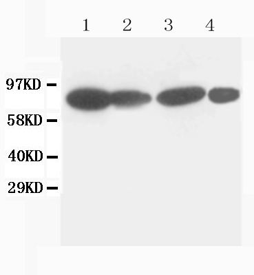 Anti-Catenin Gamma (Plakoglobin) Jup Antibody (Monoclonal, 35J59)
