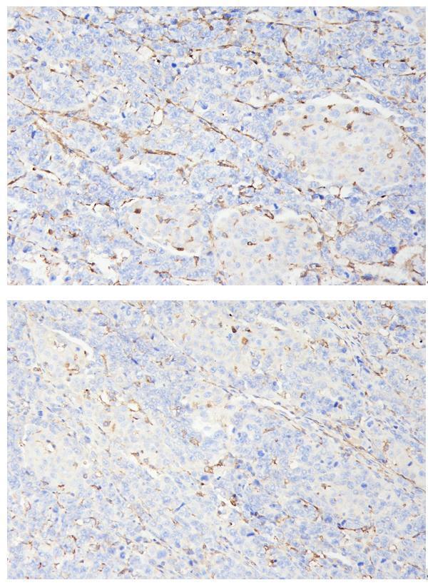  IHC analysis of CD8 using anti-CD8 antibody (MA1017)
