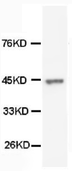 Anti-Cytokeratin Peptide 18 KRT18 Antibody (Monoclonal, 35K72)