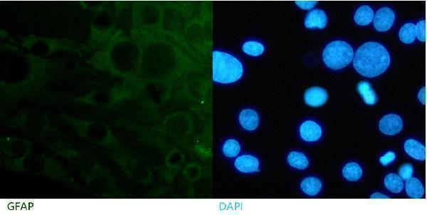 ma1045 gfap primary antibodies icc testing 1