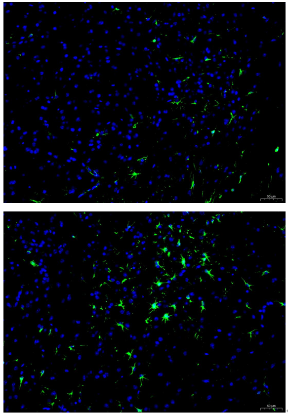 ma1045 gfap primary antibodies if testing 1