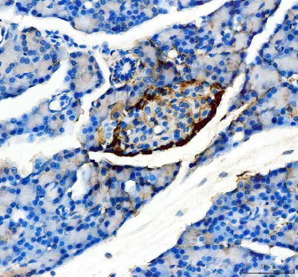 ma1047 glucagon primary antibodies ihc testing 2