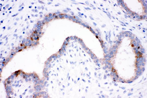 ma1050 hsp70 primary antibodies ihc testing 2