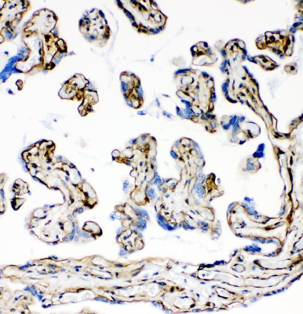 ma1054 laminin primary antibodies ihc testing 1