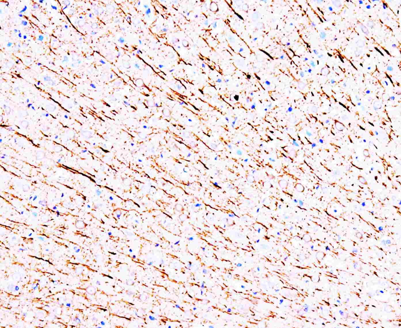 Anti-MAP1 Antibody (Monoclonal, 31M04)