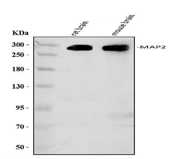  Western blot analysis of MAP2 using anti-MAP2 antibody (MA1057)