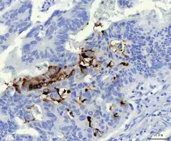 ma1061 mucin gastric primary antibodies ihc testing 1