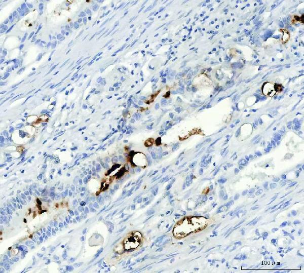 ma1061 mucin gastric primary antibodies ihc testing 2