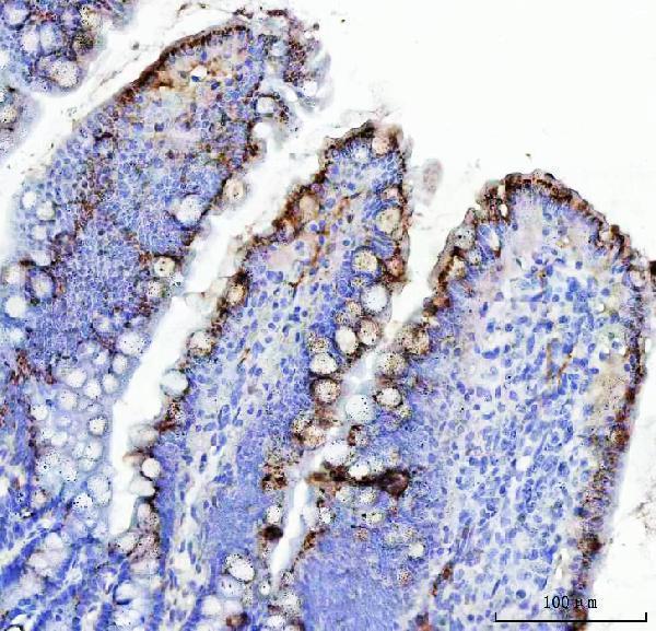 ma1061 mucin gastric primary antibodies ihc testing 3