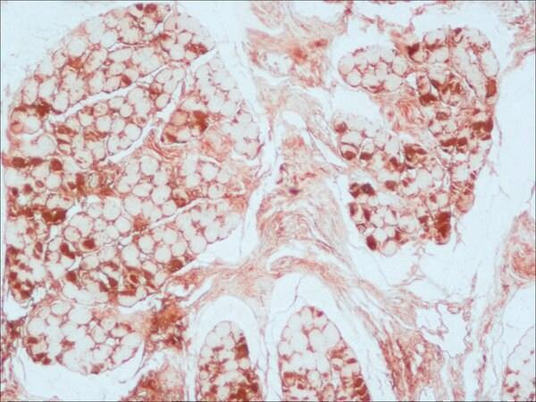 ma1062 myoglobin primary antibodies ihc testing 1