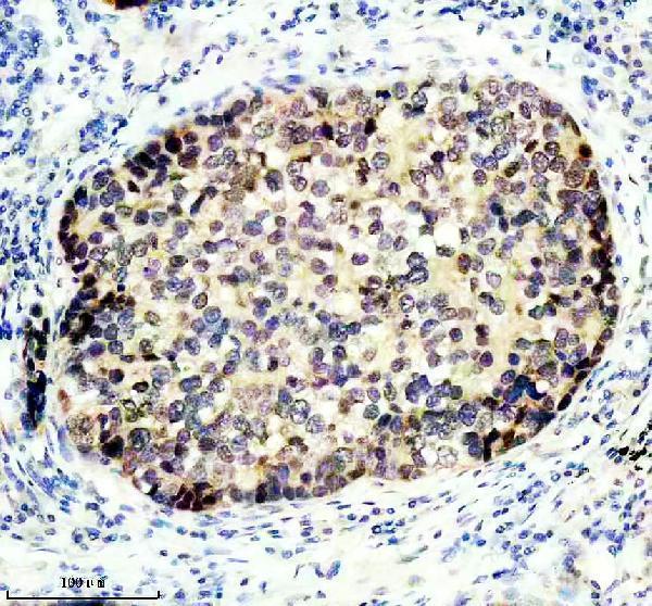 ma1074 cdkn2 primary antibodies ihc testing 1