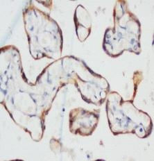 Anti-Pancytokeratin/PCK Antibody (Monoclonal, 35P75)