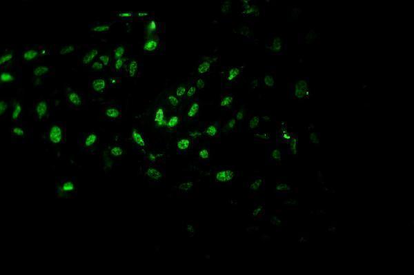 ma1083 2 pcna primary antibodies icc testing 1