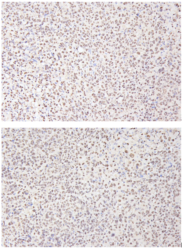 ma1083 2 pcna primary antibodies ihc review 1