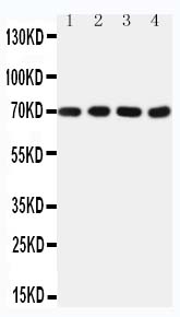 Anti-Tau Mapt Antibody (Monoclonal, 31M08)