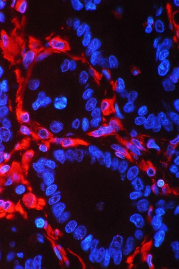 Vimentin antibody for fibroblast research